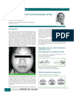 Lip Nose Deformity