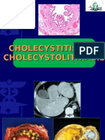 CHOLECYSTITIS With CHOLECYSTOLITHIASIS