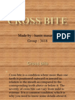 Crossbite