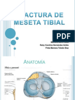 Fractura de Meseta Tibial