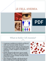 Sickle Cell Anemia