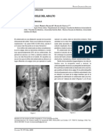 Ureterocele en El Adulto