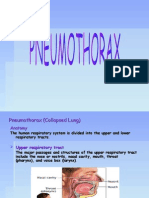 Pneumothorax (Collapsed Lung)