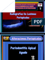 Radiografías de Lesiones Periapicales