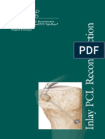 Arthroscopic Inlay PCL Reconstruction Using The FlipCutter and PCL TightRope