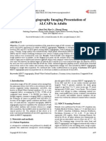 MDCT Angiography Imaging Presentation of ALCAPA in Adults: Qinyi Dai, Biao LV, Zhaoqi Zhang