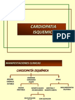 Cardiopatia Isquemica