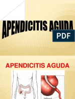 Apendicitis Aguda 2014