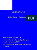 Liver Cirrhosis: Indika Bandara Gawarammana