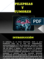 Epilepsias y Tumores