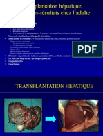 Transplantation Hepatique