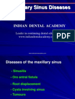 Maxillary Sinus (NXPowerLite) .PPT / Orthodontic Courses by Indian Dental Academy