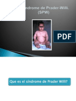 Sindrome de Prader Willi.