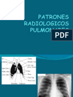 Patrones Radiologicos Pulmonares