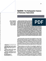 Update:: The Radiographic Features of Pulmonary Tuberculosis