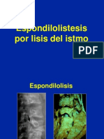 6 - Espondilolistesis