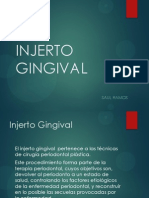 Injerto Gingival