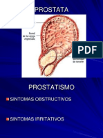 PROSTATISMO