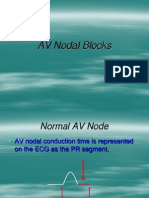 AV Nodal Blocks