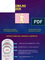 Linfoma No Hodgkin