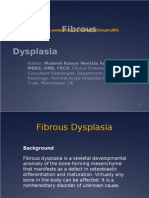 Fibrous Dysplasia