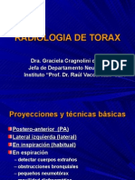 Radiologia de Torax