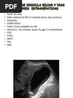 Cancer de Vesicula Biliar