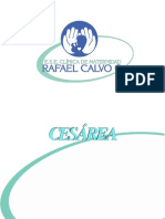 Cesarea