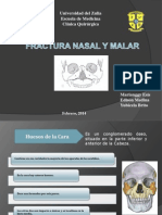 FX Nasal y Malar