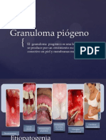 Granuloma Piogeno Corregido