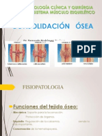 Consolidacion Osea