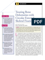 Treating Bone Deformities With Circular External Skeletal Fixation