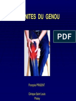 Tendinites Du Genou