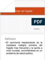 Cáncer de Hígado