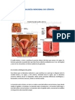 Patología Benigna de Cérvix