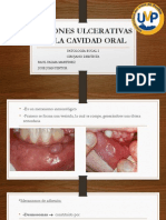 PATOLOGIA BUCAL I - Lesiones Ulcerativas