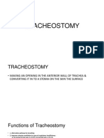 Tracheostomy