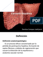 Cirrosis Presentacion