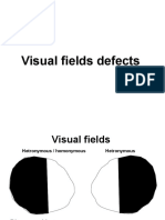 Field Defects