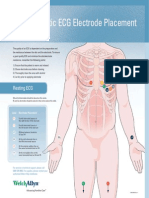 AHA Diagnostic ECG Electrode Placement