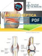 Artritis Séptica