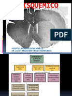 Evc Isquemico 2013