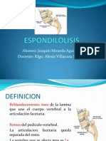 Espondilolisis 