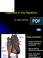 Cyanosis in The Newborn