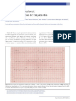 Taquicardia Biderecional