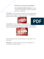 Clasificación de Las Maloclusiones