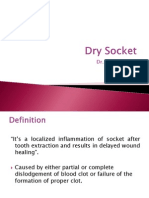 Dry Socket