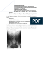 Abdominal X Rays Made Easy: Normal Radiographs: o X Rays Are Passed From Front To Back (Anteroposterior Projection) of A