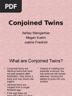 Exconjoined Twins