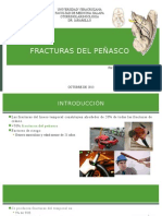 Fracturas Del Peñasco